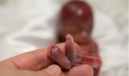 Fotos de bebé prematuro impactan en las redes sociales