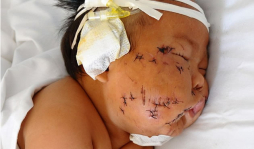 Madre apuñala 90 veces a su bebé porque la mordió mientras lo amamantaba