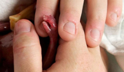 Fotos de bebé prematuro impactan en las redes sociales