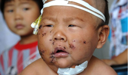 Madre apuñala 90 veces a su bebé porque la mordió mientras lo amamantaba