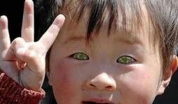 Niño ve en la oscuridad debido a rara condición