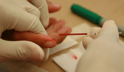 60% de pacientes con VIH están sin tratamiento