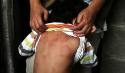 Vecinos viven en medio de aguas negras en Honduras