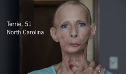 Exfumadores protagonizan dramática campaña en EUA