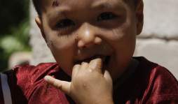 Honduras: Jeferson Codrinton, el niño que es insensible al dolor