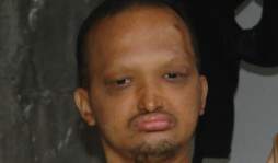 'El hombre pescado” sobrevivió a bala en la cabeza