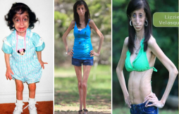 Mujer más 'fea' del mundo muestra su belleza