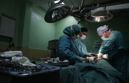 Realizarán brigada de cálculos en la vesícula en San Pedro Sula