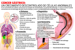 Cáncer gástrico afecta más a hombres que mujeres