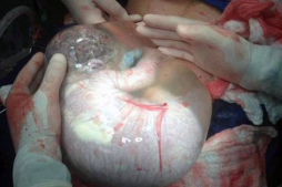 Fotos del bebé en su saco amniótico