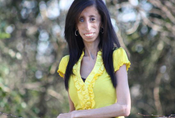 Mujer más 'fea' del mundo muestra su belleza