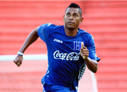 Costly y su nuevo 'look' a lo Balotelli