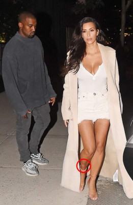 Kim Kardashian ya no puede ocultar la psoriasis