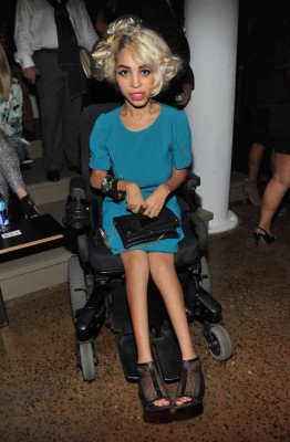 Beyoncé elige a modelo con distrofia&nbsp;&nbsp;