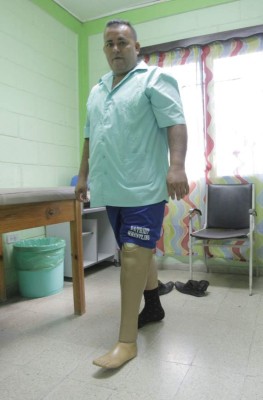 Teletón ha beneficiado a más de 2,000 personas con prótesis en San Pedro Sula