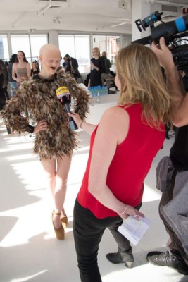 Sin pelo, ni dientes esta modelo revoluciona las pasarelas