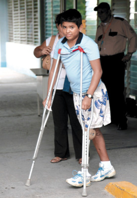 Rony ya tiene prótesis y aprende a caminar