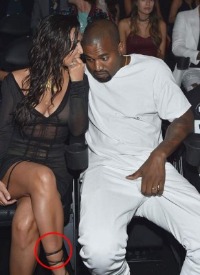 Kim Kardashian ya no puede ocultar la psoriasis