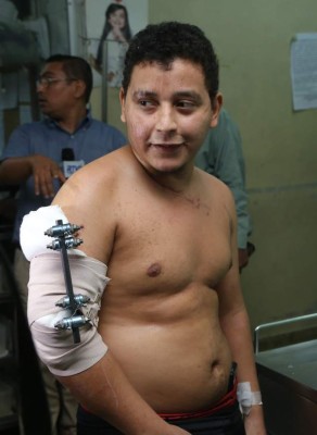 Pacientes del IHSS se arman de valor y denuncian irregularidades ante la Unaf