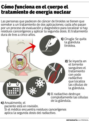 Foto: La Prensa