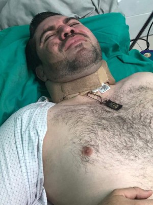 Diputado Jorge Cálix se accidenta en Santa Lucía