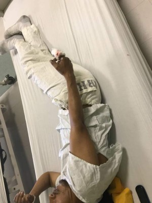 Reportan 31 quemados por uso de pólvora en la Nochebuena