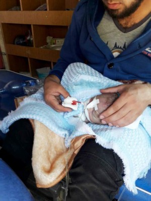 A man holds an injured baby inside a Turkish ambulance as injured Syrian people enter into Turkey from the Cilvegozu border gate in Hatay province, near the Syrian border on April 4, 2017.Turkish President Recep Tayyip Erdogan in a phone call with Russian counterpart Vladimir Putin on April 4, 2017 condemned a suspected chemical attack in northwestern Syria as an 'inhuman' strike that could endanger peace talks based in the Kazakh capital. / AFP PHOTO / DOGAN NEWS AGENCY / - / Turkey OUT