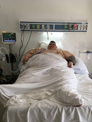This handout picture released by Gastric Bypass Mexico hospital press office shows Mexican 32-year-old Juan Pedro Franco at the intensive care room, where he recovers after an operation to reduce weight in Guadalajara, Jalisco state, Mexico on November 23, 2017. Franco was the heaviest man in the world, but almost a year ago he underwent a treatment and managed to lose about 200 kg. He now underwent surgery again with the hope of walking again after seven years of not doing so. / AFP PHOTO / Gastric Bypass Mexico / HO / RESTRICTED TO EDITORIAL USE - MANDATORY CREDIT 'AFP PHOTO / GASTRIC BYPASS MEXICO ' - NO MARKETING - NO ADVERTISING CAMPAIGNS - DISTRIBUTED AS A SERVICE TO CLIENTS --- TO GO WITH AFP STORY by YEMELI ORTEGA
