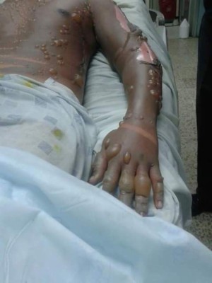 Cae otro integrante de la banda de los Cálix