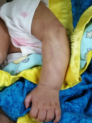 Investigan a quinceañera por azotar a su bebé con cables