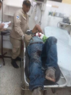 Accidente en Santa Rosa de Copán deja dos heridos