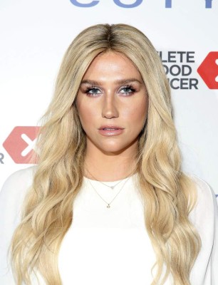 El nuevo look de Kesha ahora es verde limón