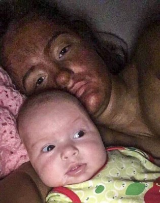 Quiso dejar de ser blanca y el resultado fue terrible