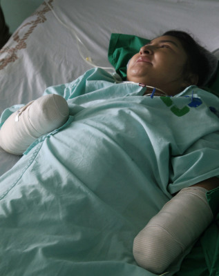 'Quisiera poder abrazar a mis hijos”: mujer atacada a machetazos