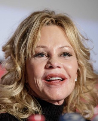Melanie Griffith luce irreconocible tras operación por cáncer de piel