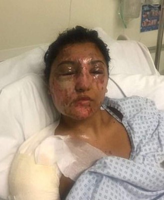 METROGRAB: 21st Birthday Acid Attackhttps://www.gofundme.com/21stbirthdayacidattackThug hurls acid over a student and her cousin as she celebrated her 21st birthday, leaving him in a comaMan threw corrosive substance through car window at Resham Khan and cousinVictims tried to drive away to escape attacker but crashed as 'pain took over'Miss Khan has had a skin graft while cousin Jameel Muhktar, 37, was put in comaManchester Met business student is 'wondering if my life will ever be the same'Her Twitter thread about the ordeal has been retweeted more than 6.9k timesMiss Khan's friends have set up a GoFundMe page to raise money for her therapy