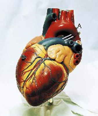 Con células madre crean válvula cardíaca