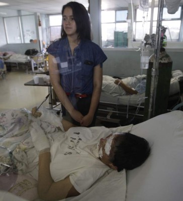 Se salva de morir por explosión de chimbo