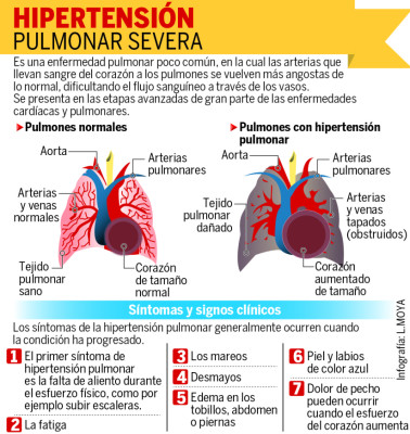 Joven sampedrana clama por ayuda para poder seguir viviendo