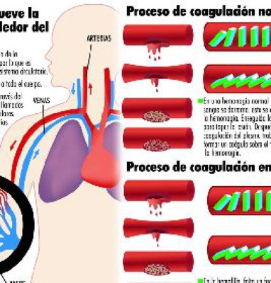 La hemofilia sólo la sufren los hombres