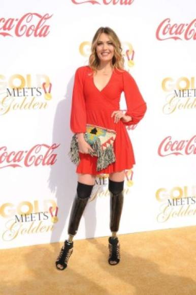 Amy Purdy<br/><br/>A sus 19 años la actriz, motivadora y atleta fue diagnosticada con una forma de meningitis bacteriana causada por Neisseria meningitidis , comúnmente conocida como meningococo, y sufrió un shock séptico.<br/><br/>Como consecuencia, sus riñones dejaron de funcionar, su bazo tuvo que ser removido y tuvieron que amputarle ambas piernas debajo de la rodilla. Dos años su padre le donó un riñón.<br/><br/>A pesar de que en el momento más crítico le dieron solo el 2% de probabilidades de supervivencia, Amy no solo sobrevivió sino que consiguó muchos logros de ahí en adelante. Comenzó a practicar snowboard siete meses después de haber recibido las prótesis para las piernas y fue en esa modalidad que se destacó a nivel mundial, ganando dos medallas en los Juegos Paralímpicos.<br/><br/>Amy también fue invitada a participar en el programa 'Danza con las Estrellas', en Estados Unidos, y fue una de las finalistas del concurso.