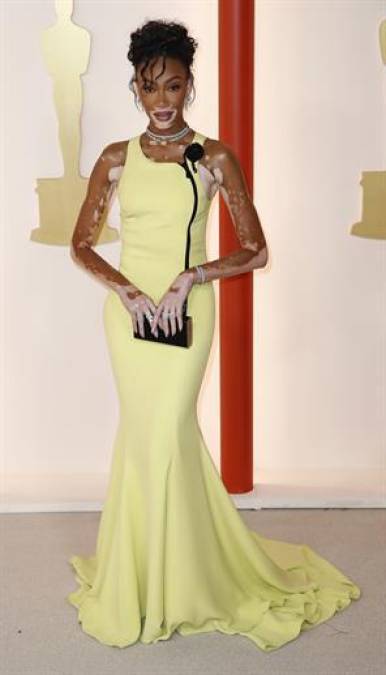 Winnie Harlow con un vestido amarillo. 