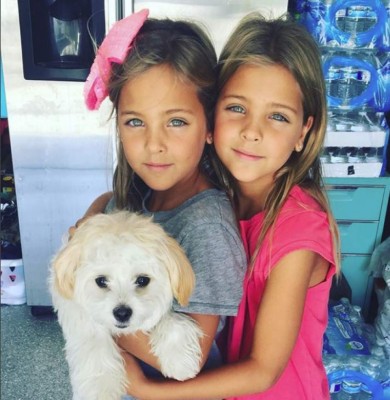 Las gemelas más bellas del mundo