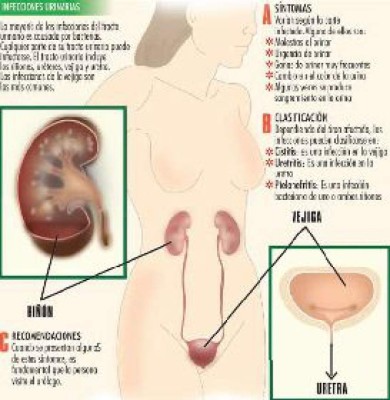 La cistitis puede afectar los riñones