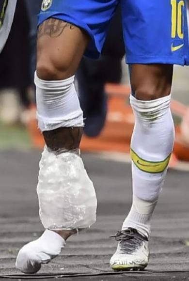 Mucho hielo le pusieron a Neymar en el tobillo derecho por la lesión. Foto AFP