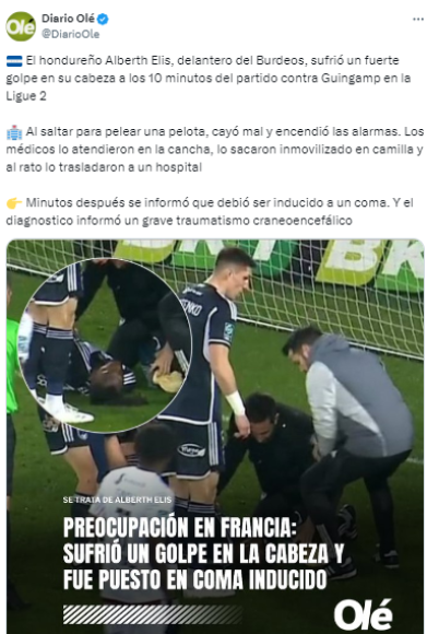 Diario Olé de Argentina: “El hondureño Alberth Elis, delantero del Burdeos, sufrió un fuerte golpe en su cabeza a los 10 minutos del partido contra Guingamp en la Ligue 2”.