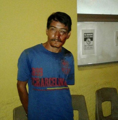 Investigan si jardinero atacó drogado a familia