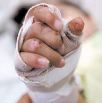 Niño de 6 años, segunda víctima de la pólvora