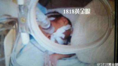 Foto cortesía del Hospital de Jinhua en China.