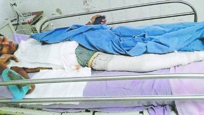 En un hospital de Culiacán está interno Bryan Escoto Luque, originario de Talanga, Francisco Morazán.